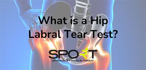 special tests for labral tear in hip|diagnostic hip injection labral tear.